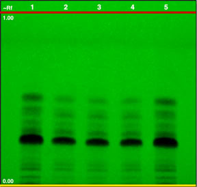 Chromatogram of piper nigrum seed 4PE